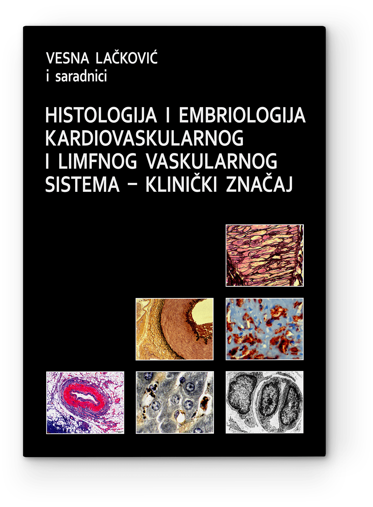 Vesna Lačković i saradnici: Histologija i embriologija kardiovaskularnog i limfnog vaskularnog sistema — klinički značaj